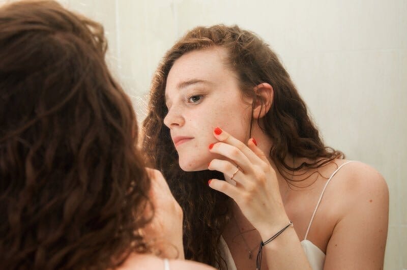 Acne Marks vs Acne Scars: How to Identify, Prevent, & Treat Each